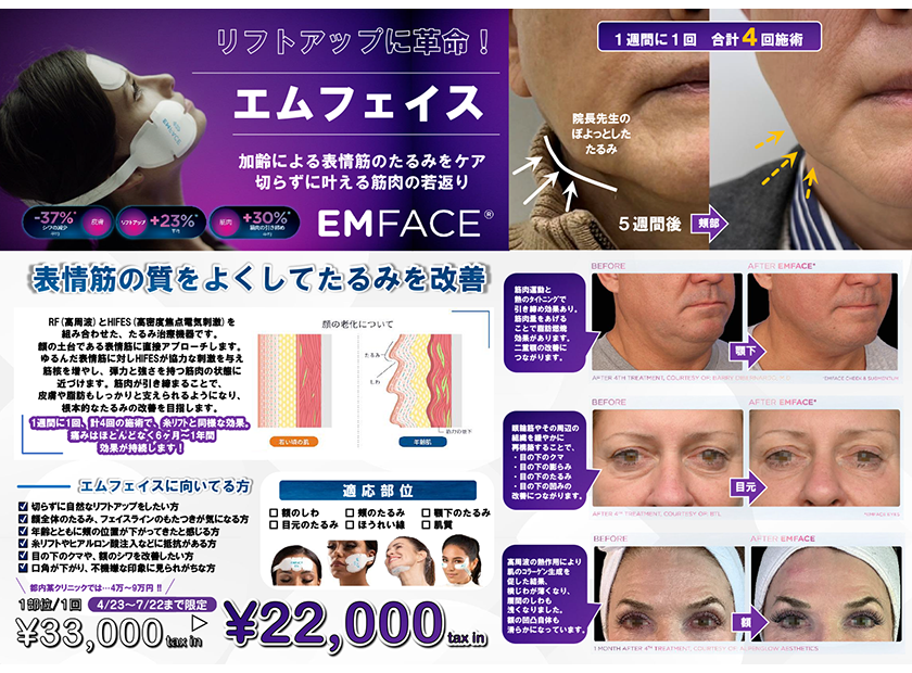 リフトアップに革命！エムフェイス～加齢による表情筋のたるみをケア～