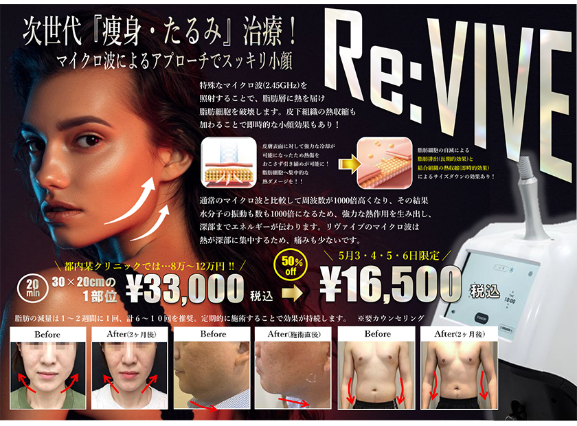 5月3,4,5,6日GW限定でなんと半額！話題の痩身・たるみ治療『リヴァイヴ』